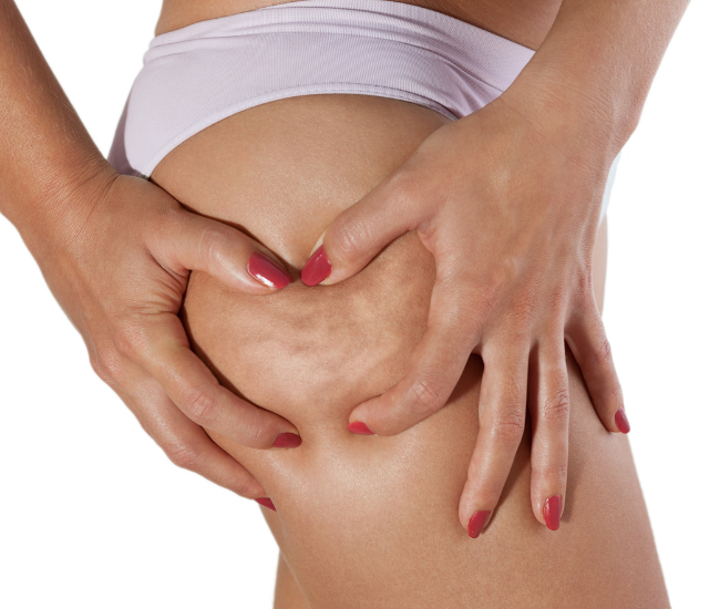 Żelazko antycellulitowe